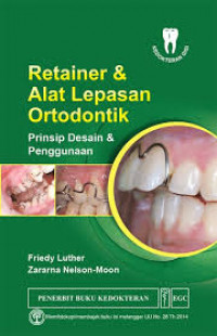 Retainer & Alat Lepasan Ortodontik: Prinsip desain & penggunaan