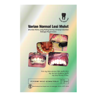 Varian normal lesi mulut : kondisi klinis yang paling sering diinterpretasikan sebagai keganasan