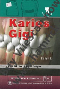 Image of Karies Gigi