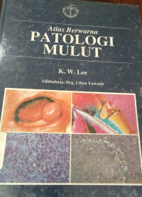 Atlas berwarna patologi mulut=A colour atlas of oral pathology