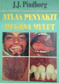 Atlas penyakit mukosa mulut